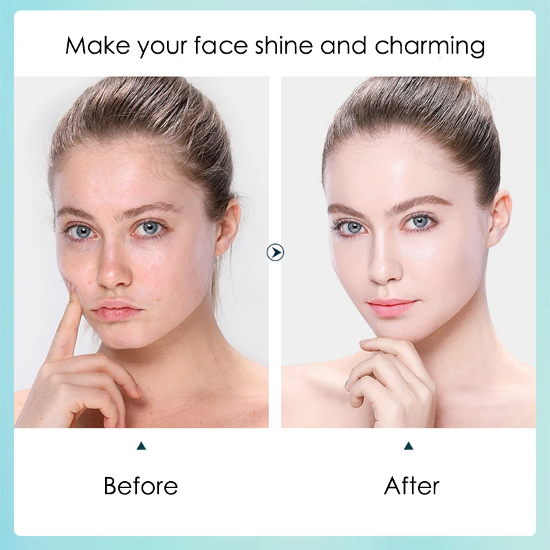 10pcs 히알루 론산 하이 드레이팅 페이셜 마스크 시 - Sheet Face Mask Pack 리뷰 및 가격